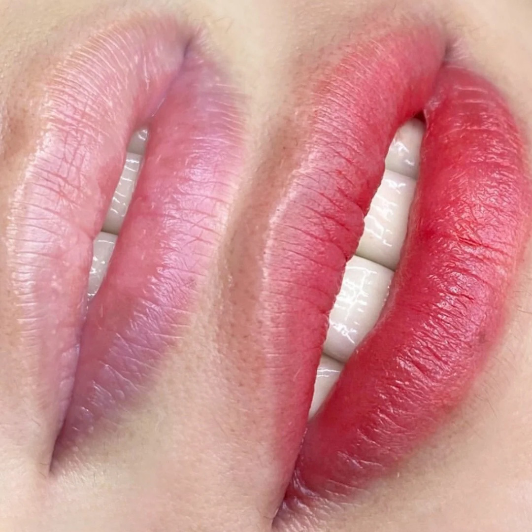 医療アートメイク症例写真　リップ　東京・恵比寿のアートメイクラボ