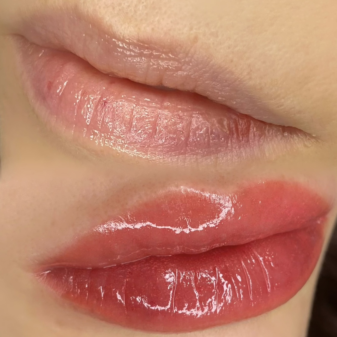 医療アートメイク症例写真　リップ　東京・恵比寿のアートメイクラボ