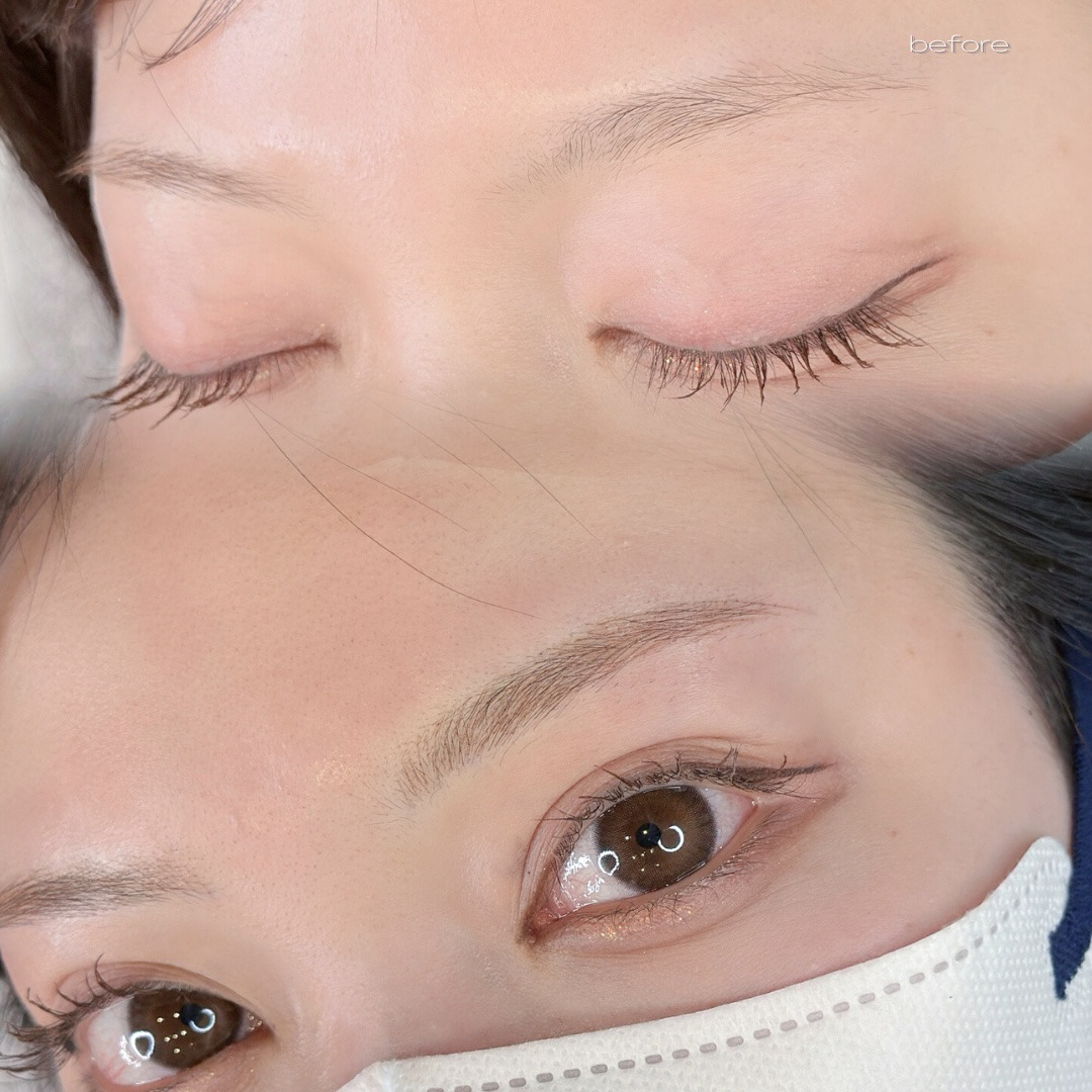 医療アートメイク症例写真　眉　マシン毛並み　東京・恵比寿のアートメイクラボ
