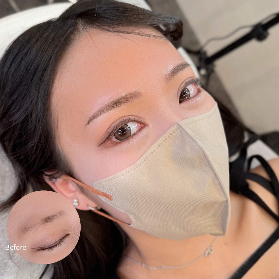 医療アートメイク症例写真　眉　パウダー　ストレート眉　東京・恵比寿のアートメイクラボ