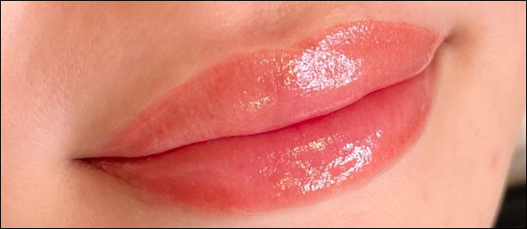 医療アートメイク症例写真　リップ　東京・恵比寿のアートメイクラボ