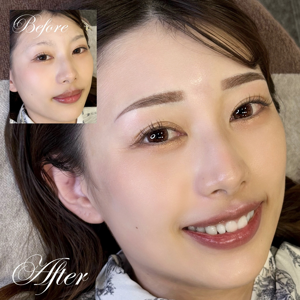 医療アートメイク症例写真　眉　マシン毛並み　東京・恵比寿のアートメイクラボ