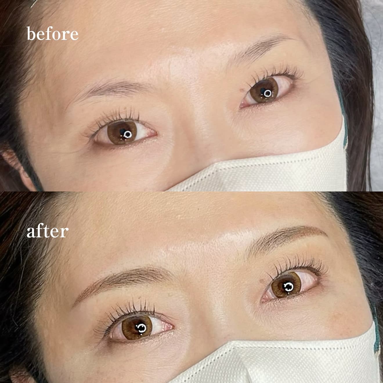 医療アートメイク症例写真　眉　毛並み技法　平行アーチ眉　東京・恵比寿のアートメイクラボ