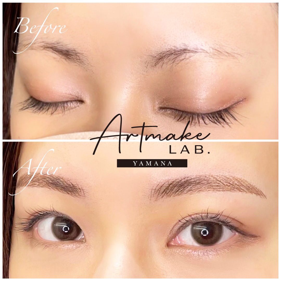 医療アートメイク症例写真　眉　毛並み+パウダー技法　平行アーチ眉　東京・恵比寿のアートメイクラボ