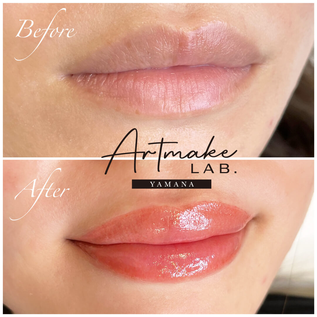 医療アートメイク症例写真　リップ　東京・恵比寿のアートメイクラボ