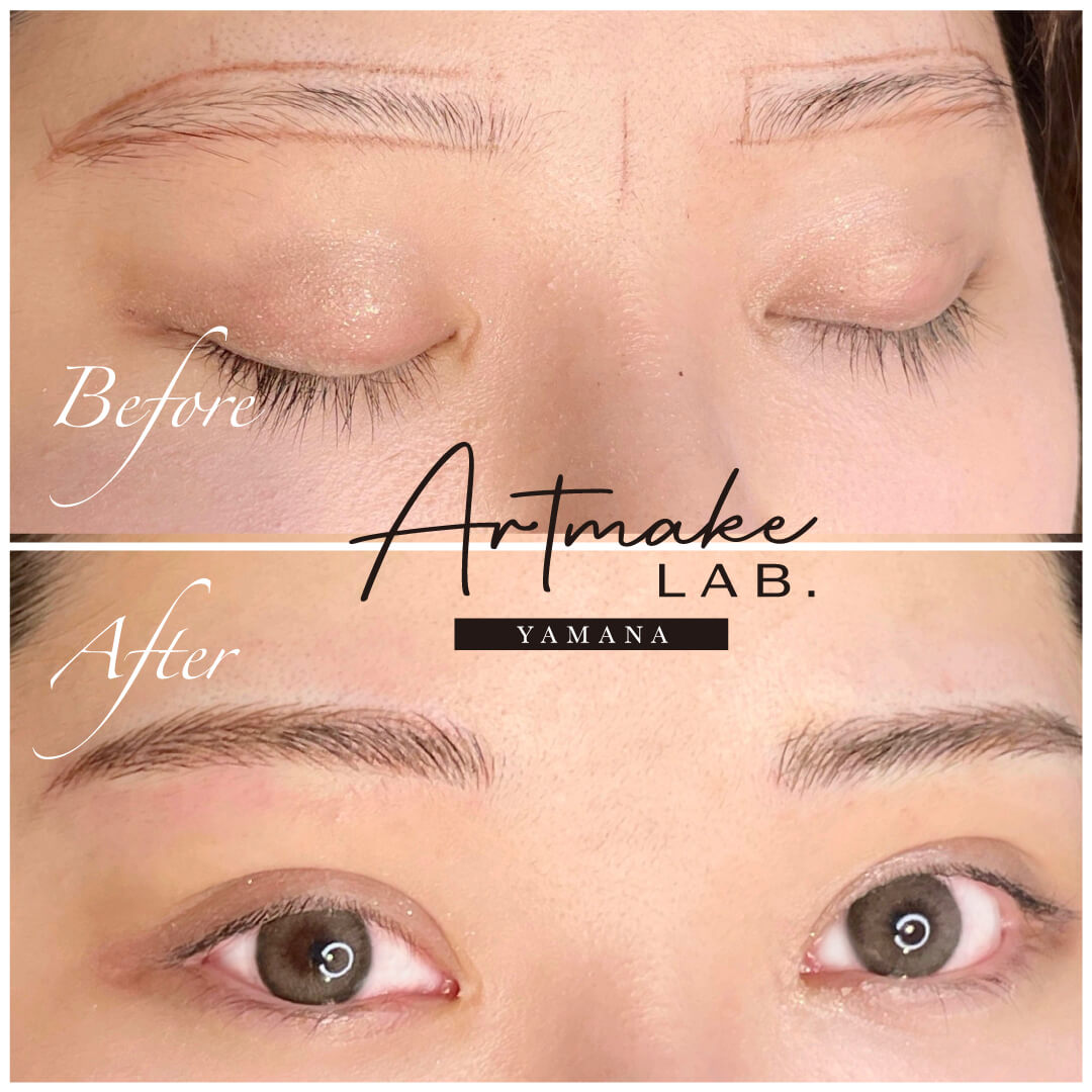 医療アートメイク症例写真　眉　毛並み+パウダー技法　平行アーチ眉　東京・恵比寿のアートメイクラボ