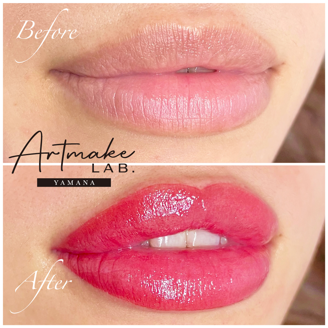 医療アートメイク症例写真　リップ　東京・恵比寿のアートメイクラボ