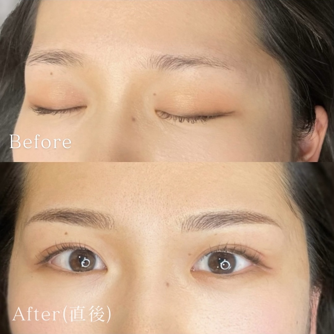 医療アートメイク症例写真　眉　毛並み+パウダー技法　少し太めのしっかりめ平行アーチ眉　東京・恵比寿のアートメイクラボ